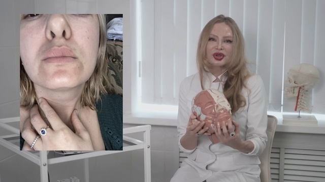 Как вернуть губы, которые были до введения филлера?