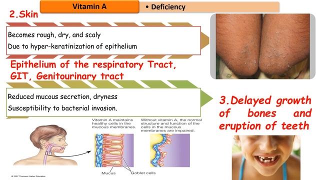MED.LEVEL 2. GIT module. BIO Lecture 6 Vitamins (part1)