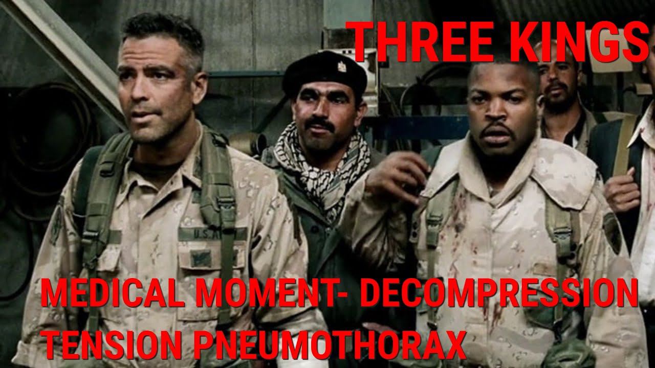 THREE KINGS - Tension Pneumothorax/ Напряженный пневмоторакс