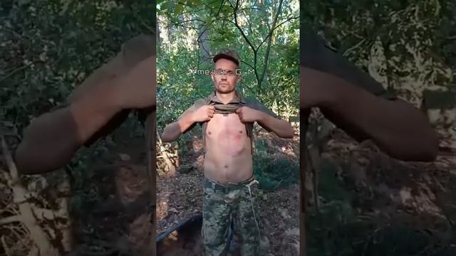 Украинские нацисты выжгли клеймо на все тело мобилизованному мужчине, который не хотел воевать за ВС