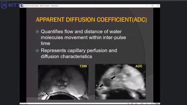Web-based Uro-radiolaogy Lecture Series GUIDE 2021 (Genito Urinary Image Directed Education)