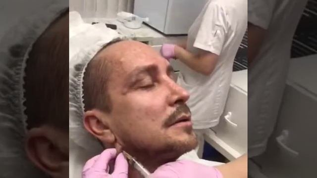 Певец Александр Данко прошел процедуру Стройное лицо в Клинике Ольги Мороз