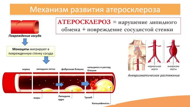 3.3. Атеросклероз