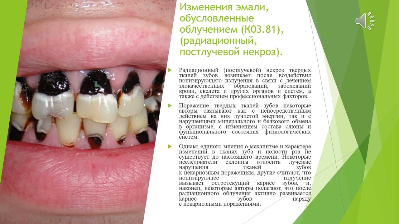 Лекция №5 для студентов 3 курса 5 семестра стоматологического факультета, французский