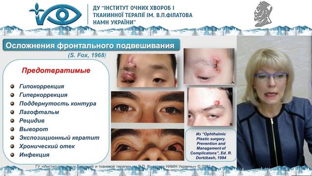 Осложнения хирургии блефароптоза, докладчик Тронина С.А.