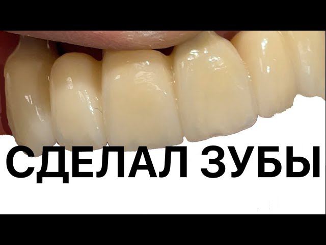 ZrO2 ceramic Сделал зубы, видео процесса. Made teeth