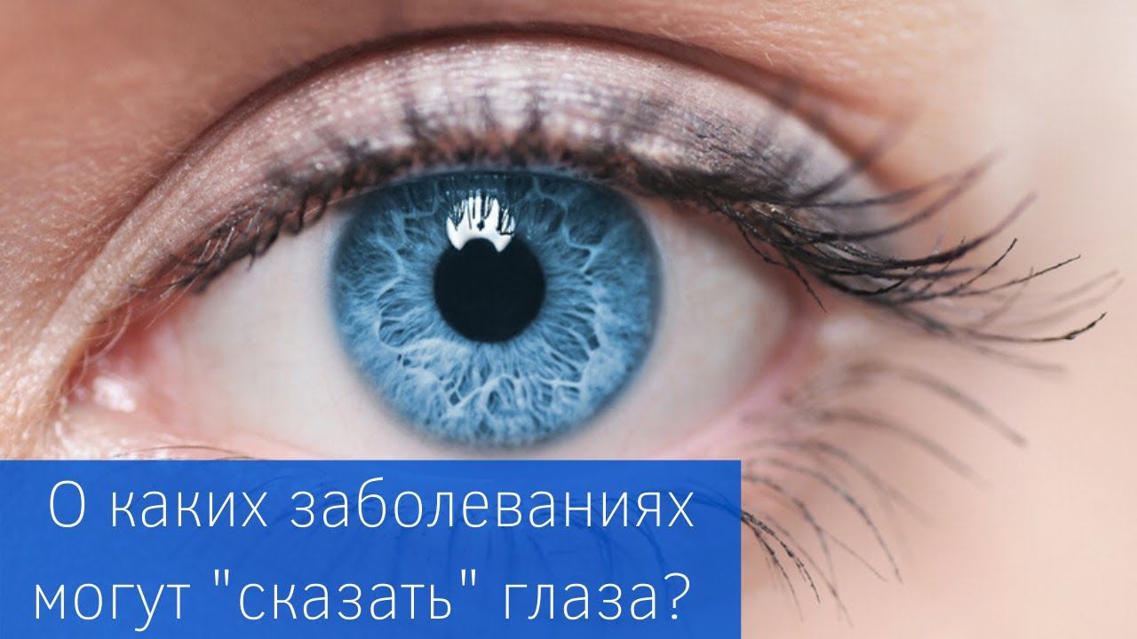 О каких заболеваниях "говорят" глаза?