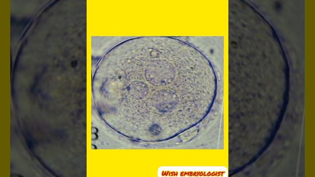 असामान्य और सामान्य निषेचन/abnorml and normal fertilization #oocyte#fertilization#ivf#embryo#sperm