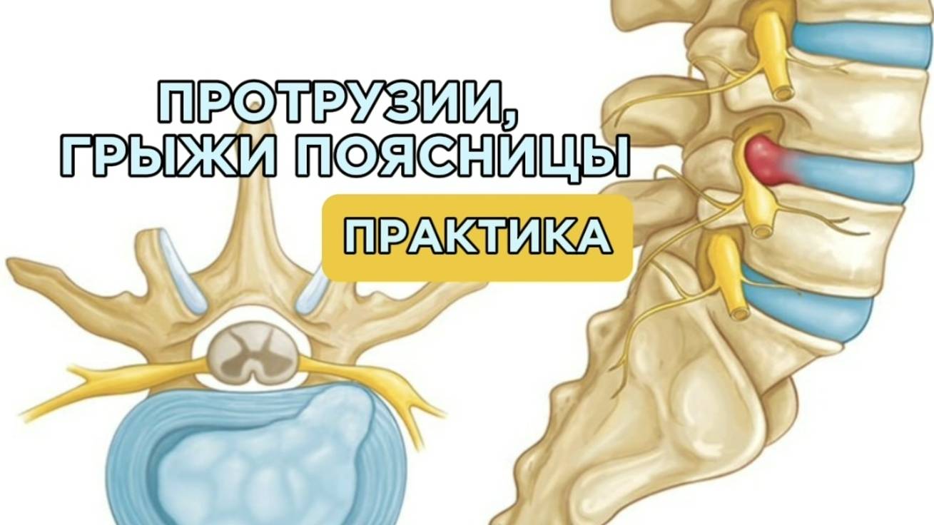 ТРЕНИРОВКА ПРИ БОЛЯХ В ПОЯСНИЦЕ