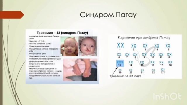 Биология 10 класс  Бернадская Г.Н.  Черниговская ОШ Хромосомные заболевания человека