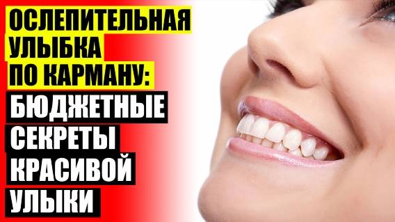 😀 Из чего сделаны виниры для зубов ☑ Виниры tru smile