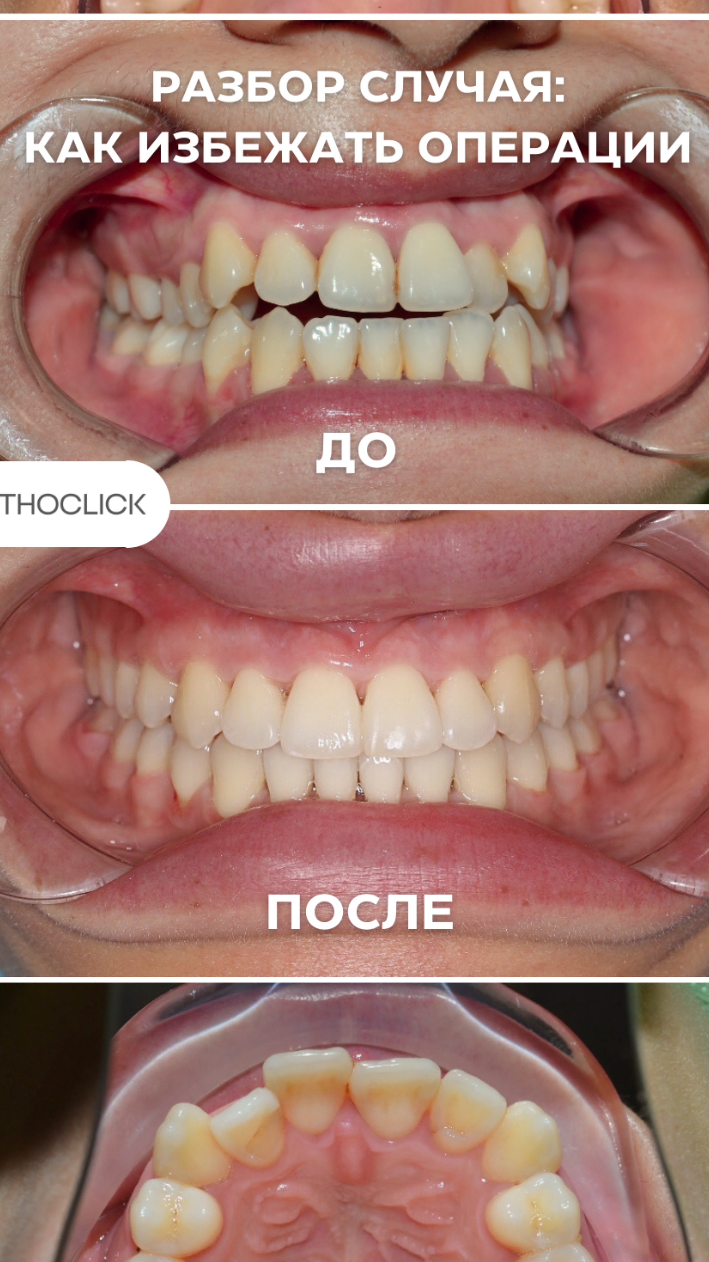 Хотите улыбку, которая будет радовать каждый день?