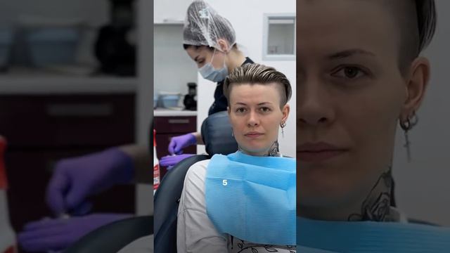 Удаление зуба мудрости - страшно или нет?