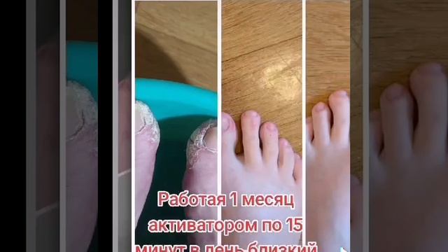 Рекомендую 👍 Активатор клеток WHIEDA