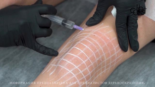 МАСТЕР-КЛАСС «Коррекция возрастных изменений области коленей с помощью COLLOST® Micro»