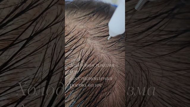 1000028617.mp4