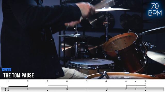 20 MUST KNOW Drum Fills For Beginner Drummers