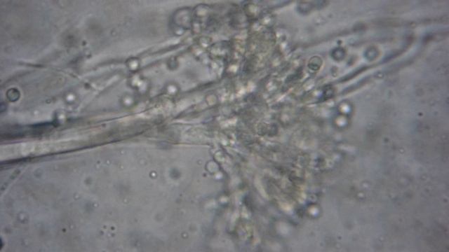 aspergillus