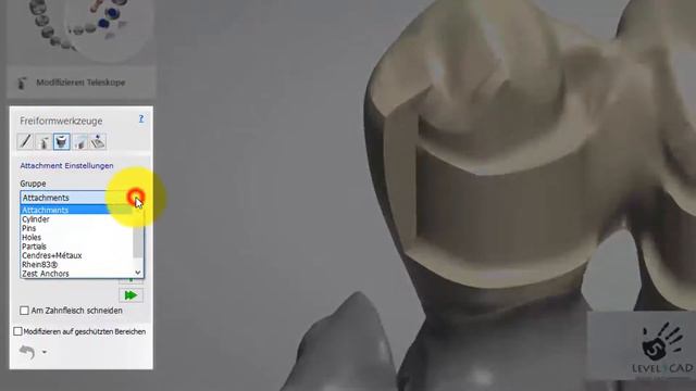Teaser 3Shape Umlauf Interlock