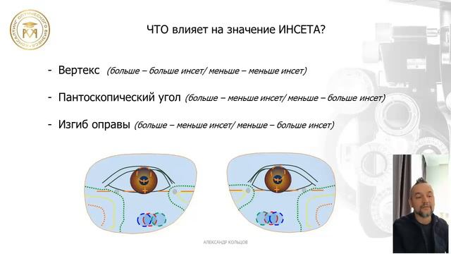 Вариабельный инсет. Полезное от КМК