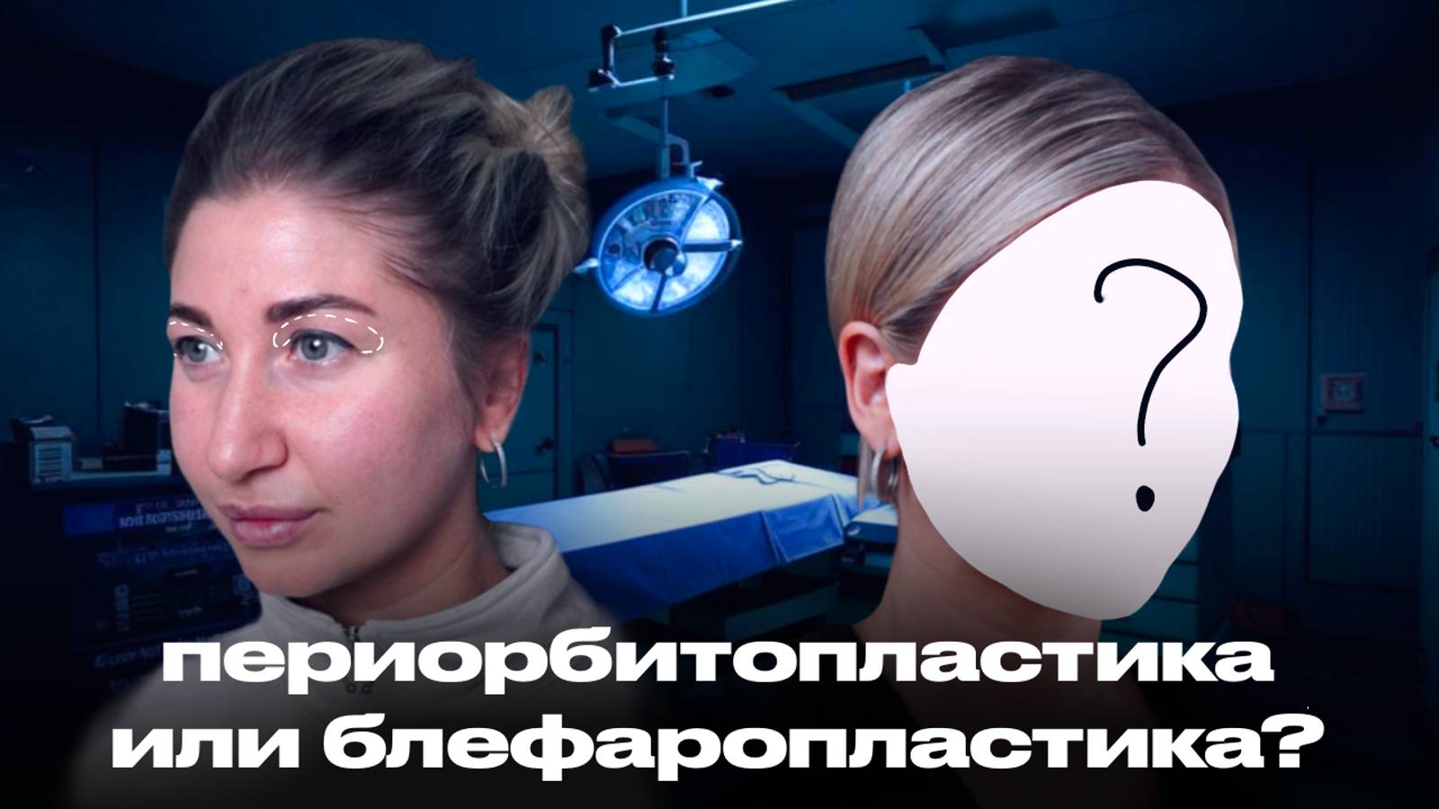 ПЕРИОРБИТОПЛАСТИКА ПРОТИВ БЛЕФАРОПЛАСТИКИ