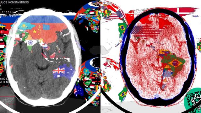 CT scan + Flag map + Flag globes + BCH address (10s*20fps*512p)