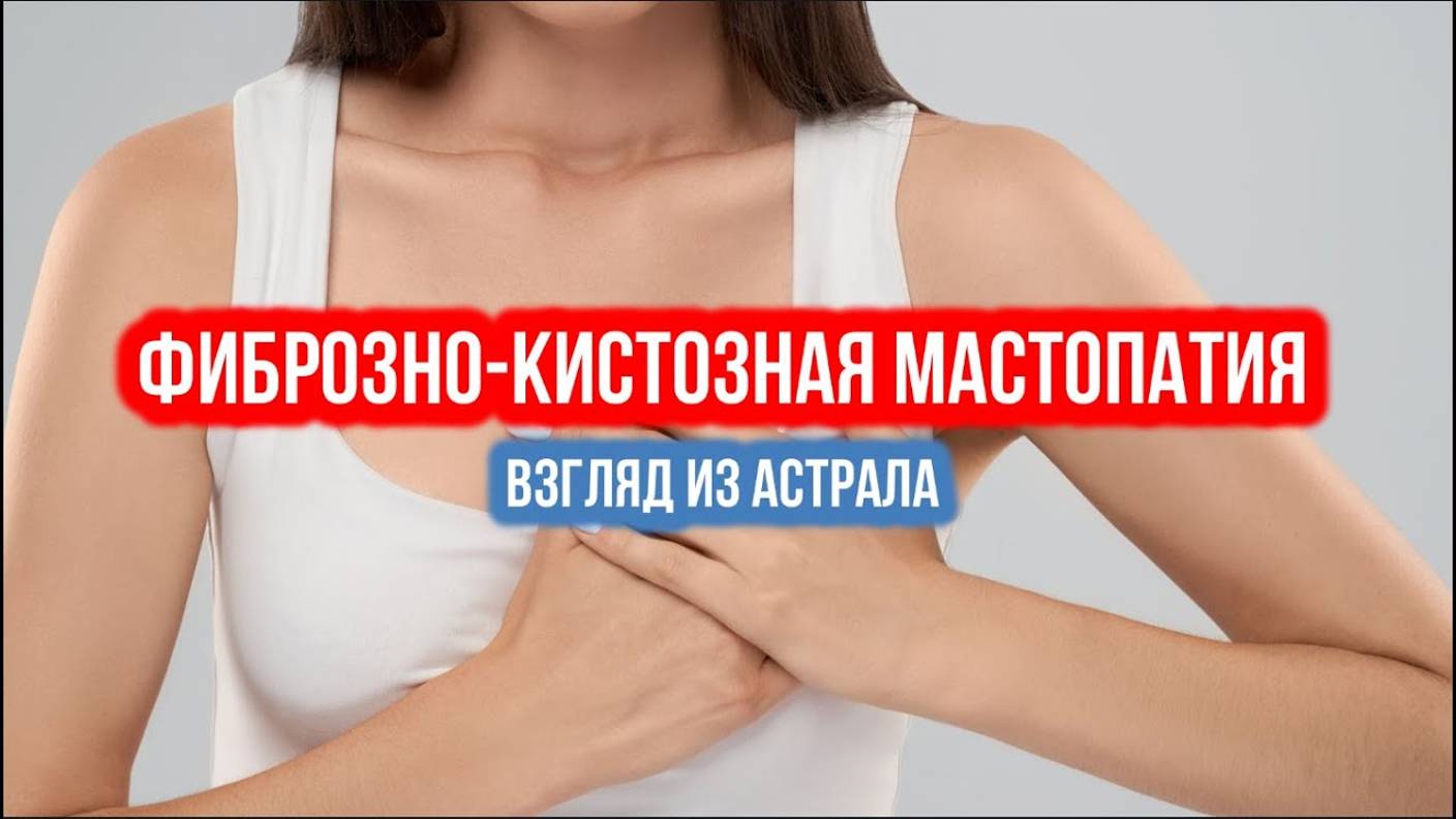 ФИБРОЗНО КИСТОЗНАЯ МАСТОПАТИЯ: ВЗГЛЯД ИЗ АСТРАЛА