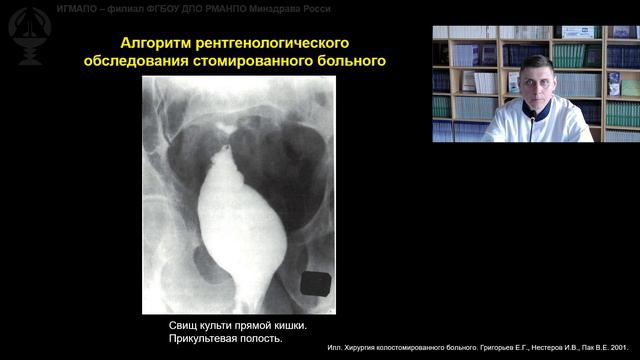 Реабилитация стомированных больных. Лекция2. Муратов А.А.