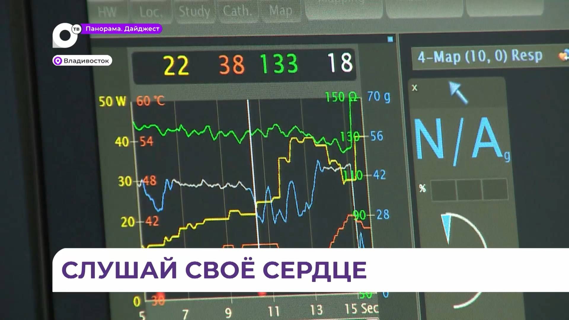 Около 800 приморцев в год нуждаются в имплантации кардиостимуляторов