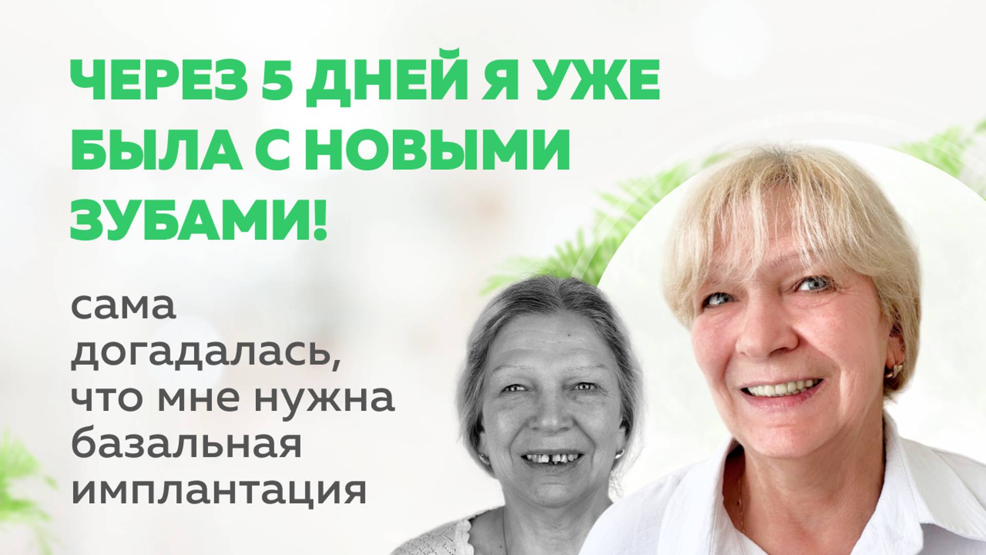 "У меня оставалось 14 зубов" Всего 5 дней до полноценной улыбки | Стратегическая имплантация
