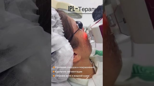 Аппарат для свето-импульсной терапии OPT ITONING