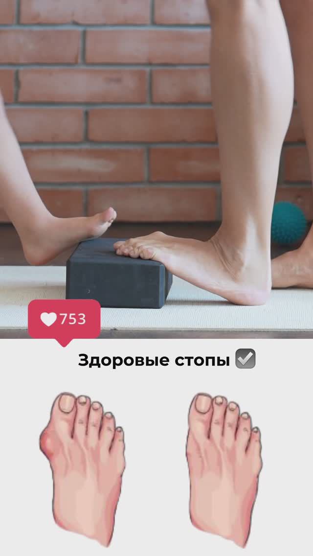 Стопы - это фундамент здоровья ✅