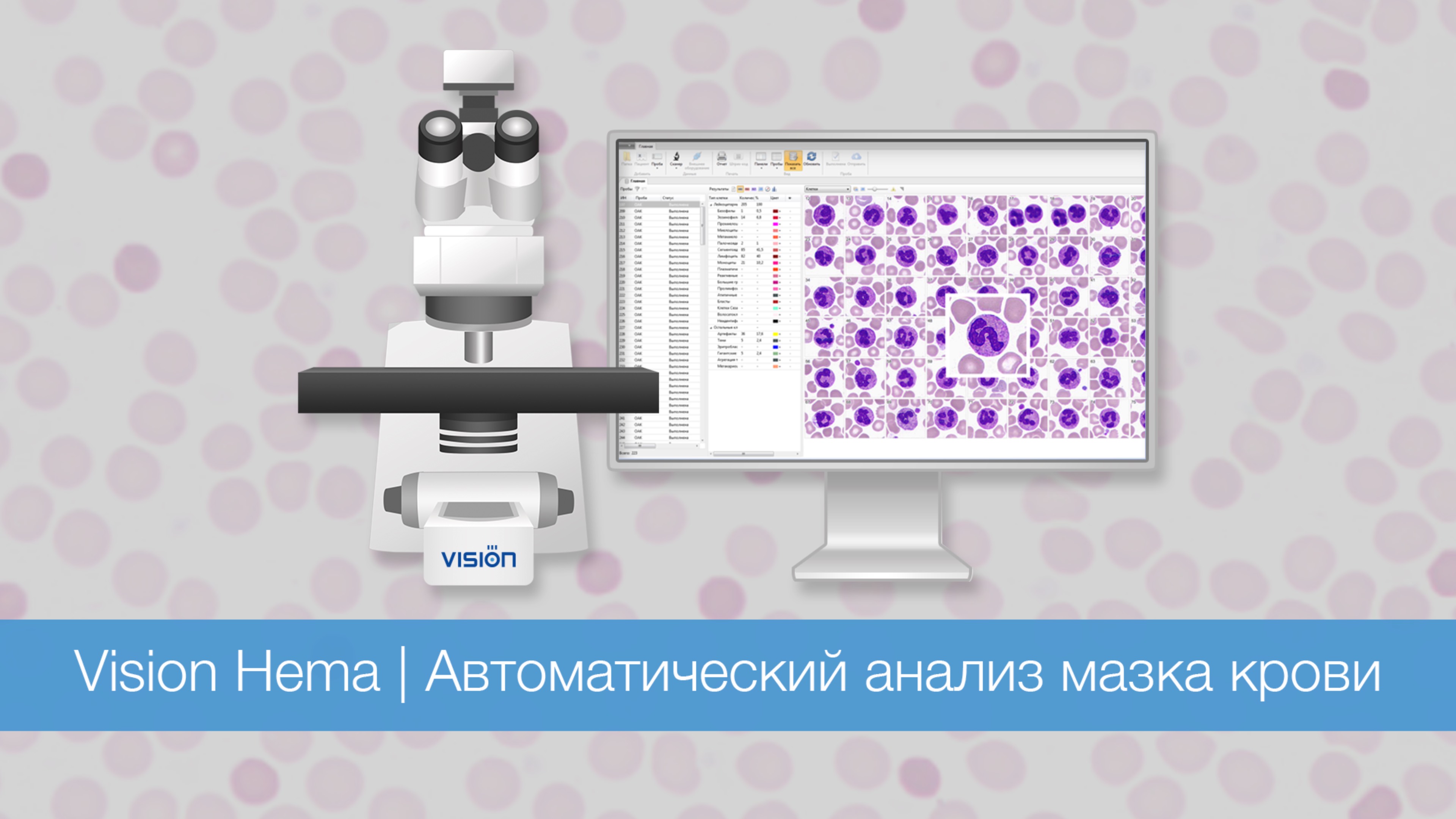 Vision Hema | Автоматический анализ мазка крови | West Medica