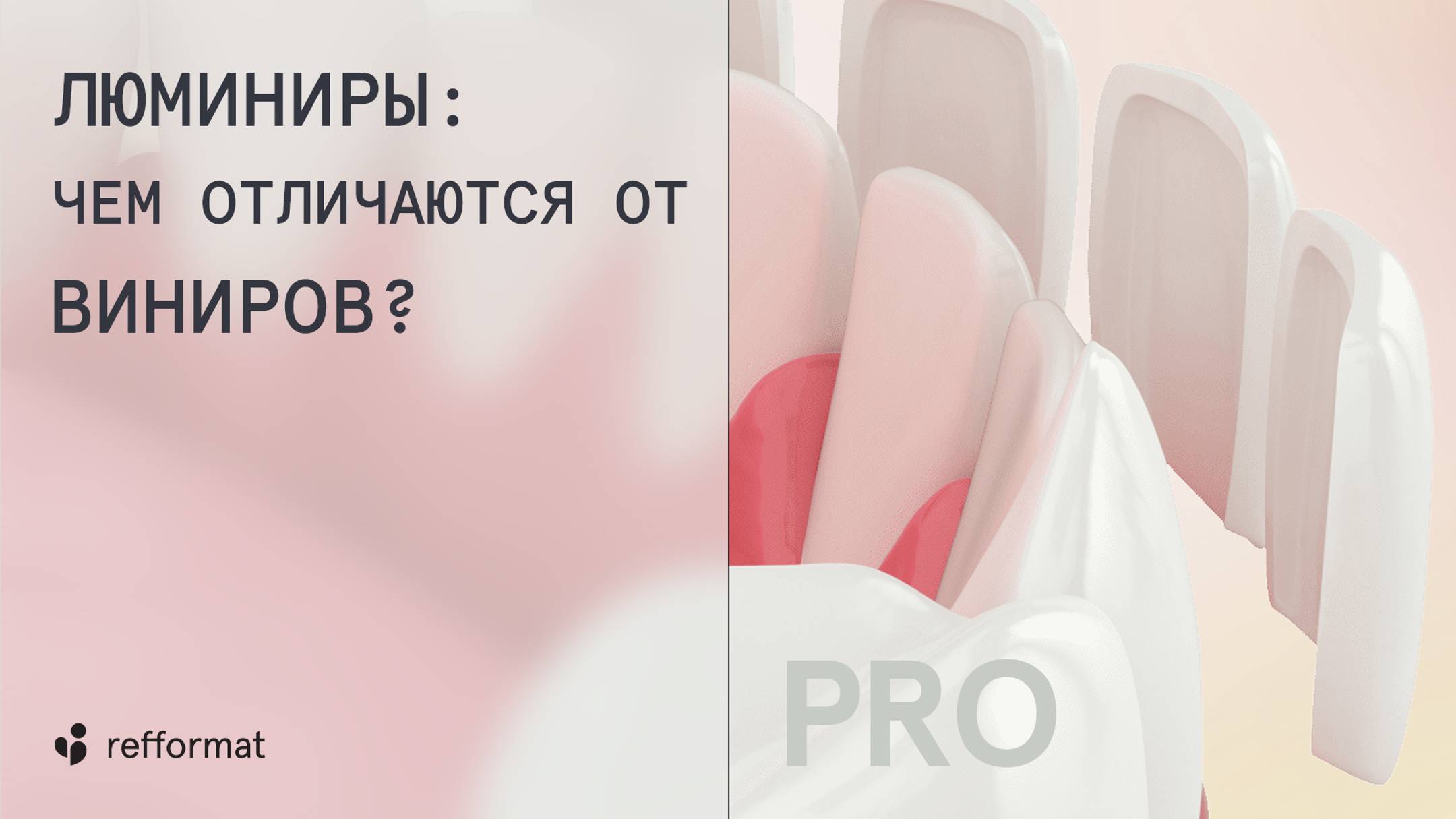 🧐 Люминиры: чем отличаются от виниров?