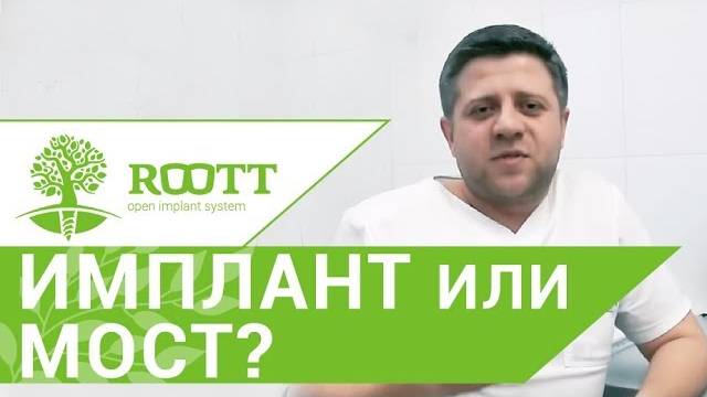 Плюсы имплантации зубов. ➕ Стоматолог - ортопед о плюсах имплантации зубов. ROOTT