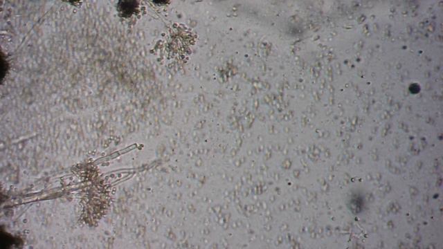 aspergillus