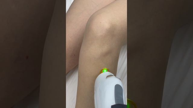 Лазерная эпиляция александритовым лазером в Екатеринбурге