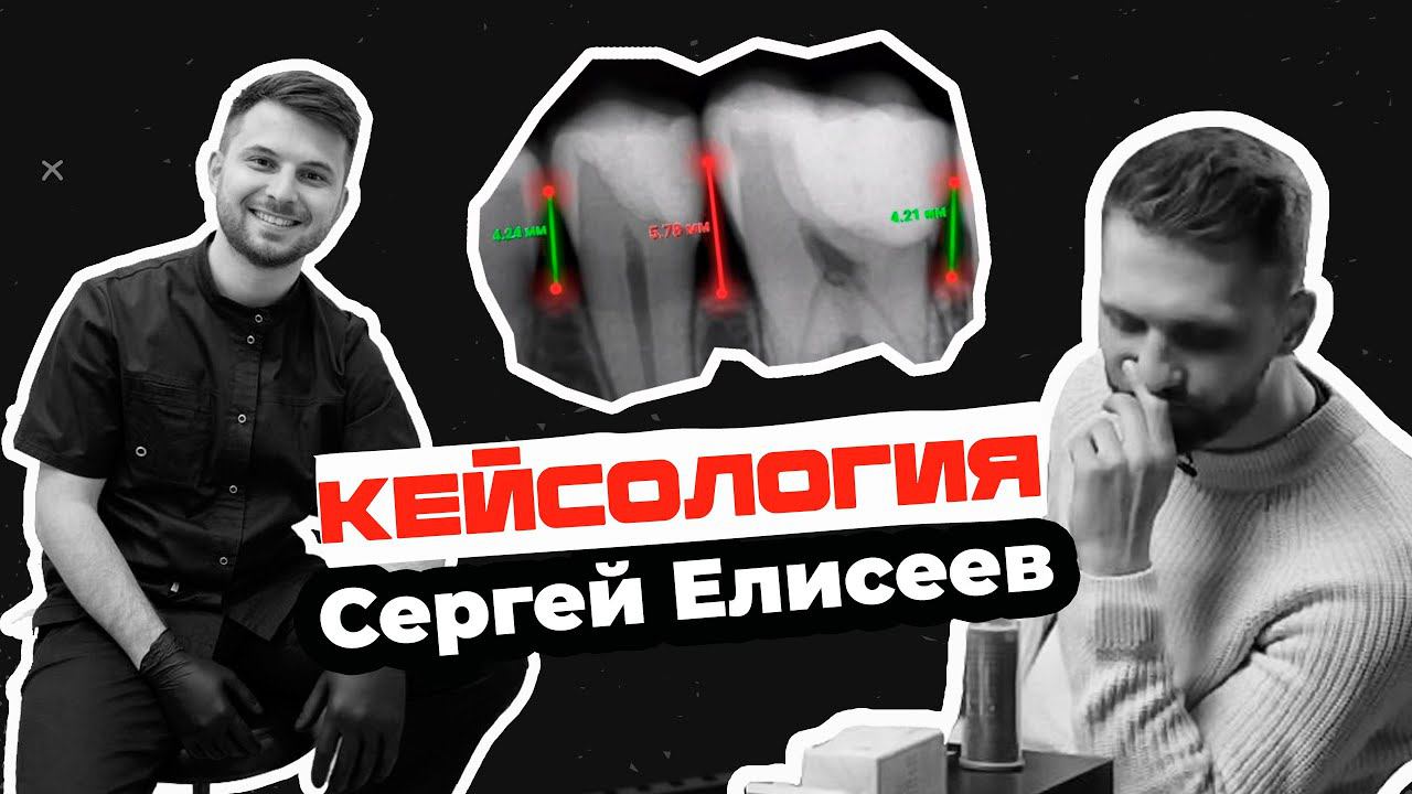 Сергей Елисеев - кейсология