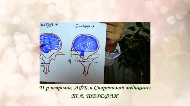ПРОТРУЗИЯ или ГРЫЖА?