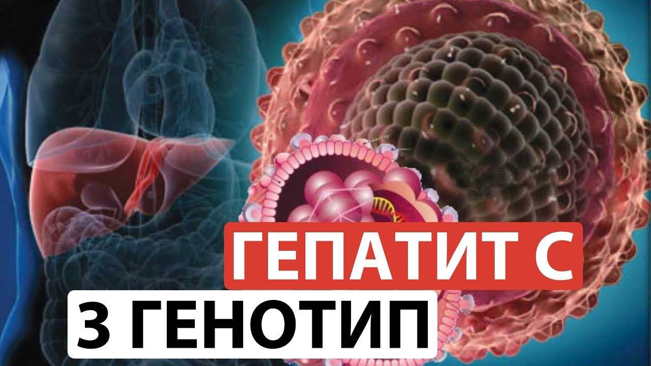 Гепатит С. 3 генотип. этого не знает 90% врачей. Это спасет ваше здоровье и деньги!