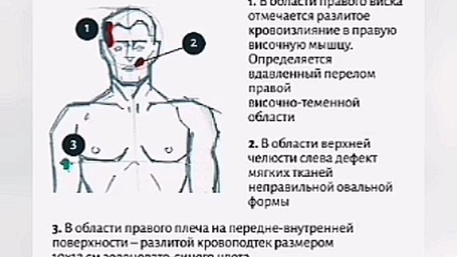 Четверо задохнулись в ручье. Николай Тибо-Бриньоль.