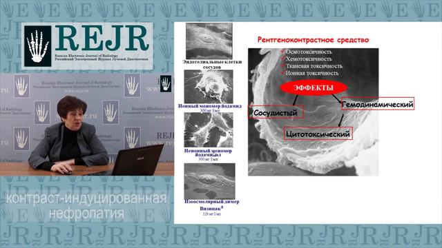 Контраст-индуцированная нефропатия (часть3)