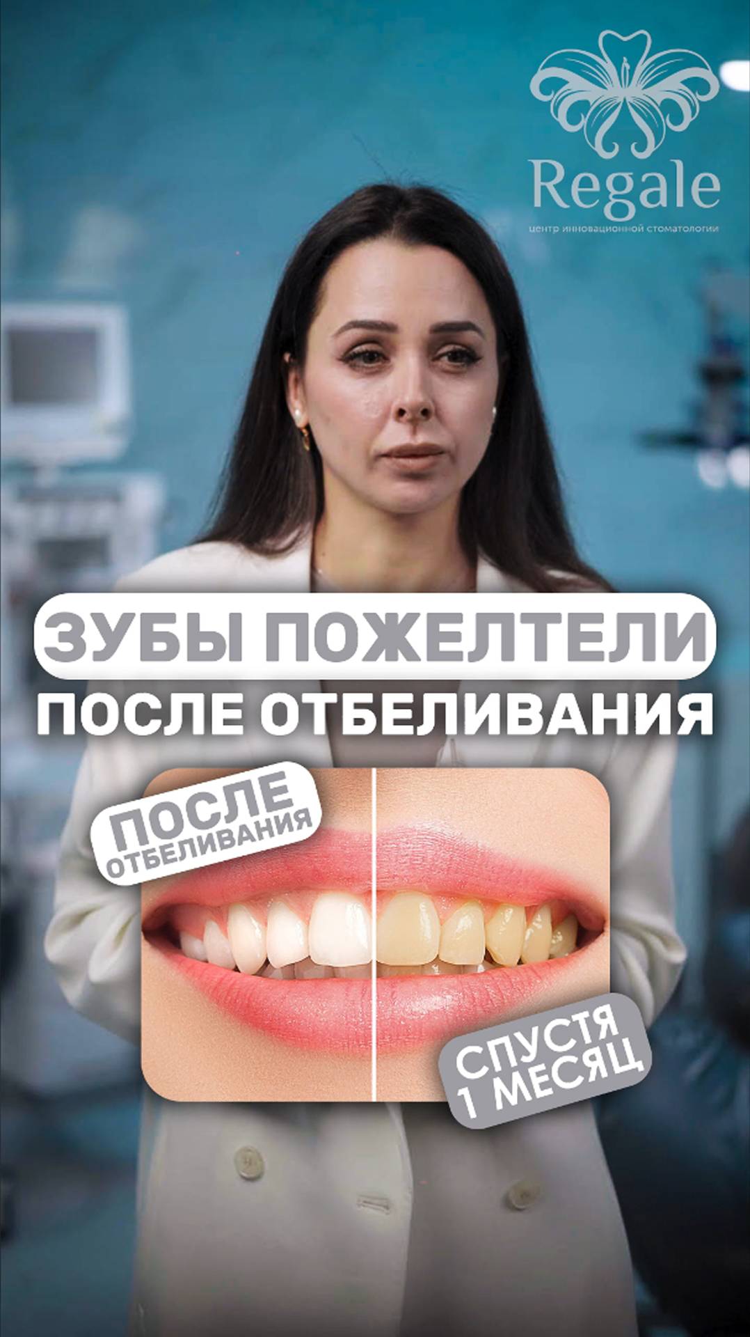 Сколько держится эффект отбеливание зубов? #отбеливаниезубов #стоматолог #советыстоматолога