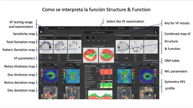 Charla sobre Campo Visual entre dos GENIOS. Prof Dr Juan Sampaolesi y el Prof Dr Curt Hartleben