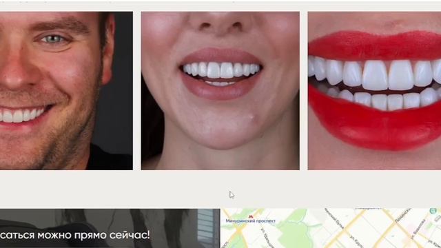 Сайт для стоматологической клиники Smile spa