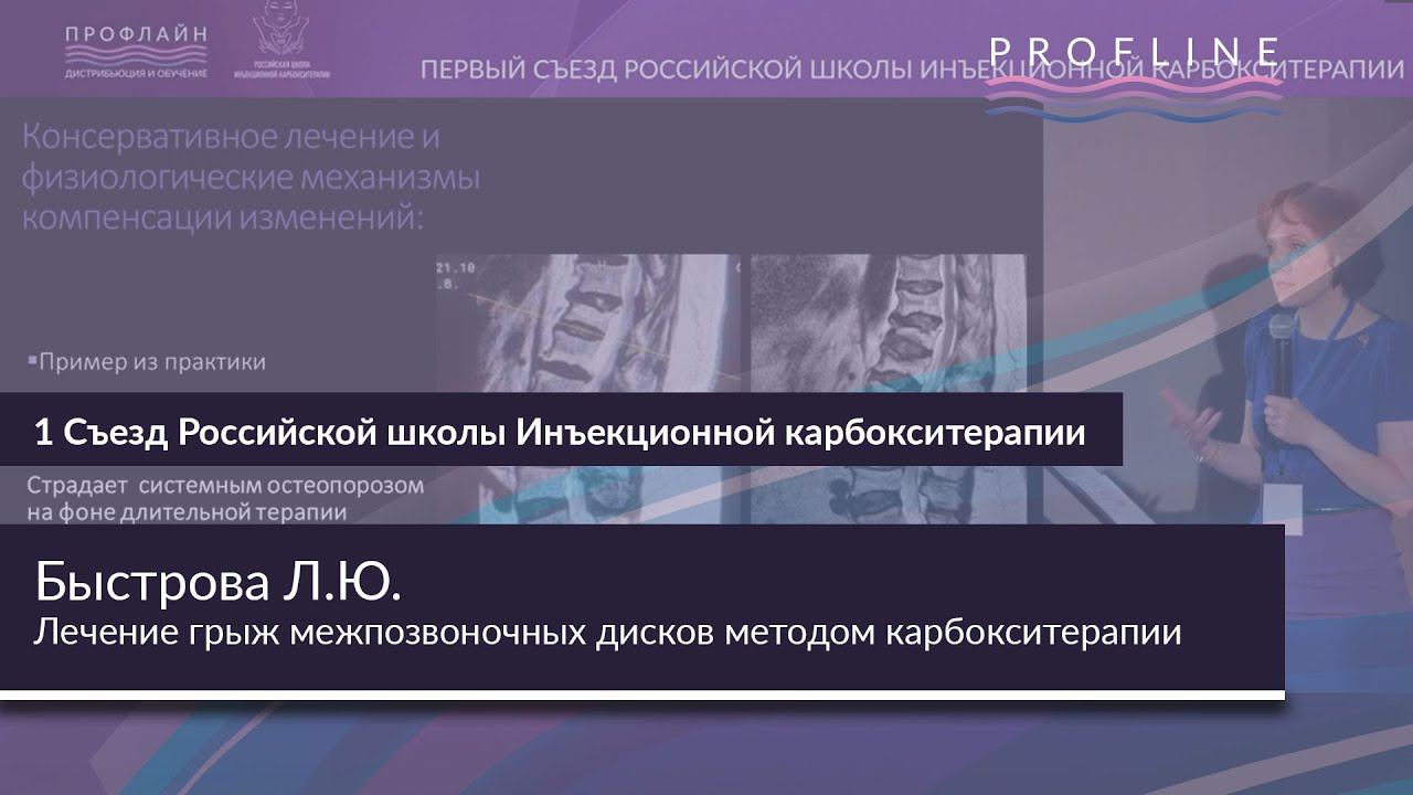 ЛЕЧЕНИЕ ГРЫЖ МЕЖПОЗВОНОЧНЫХ ДИСКОВ МЕТОДОМ КАРБОКСИТЕРАПИИ || Спикер: БЫСТРОВА ЛАРИСА ЮРЬЕВНА