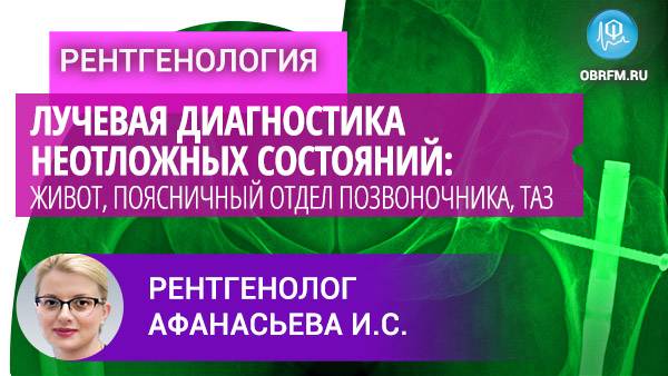 Лучевая диагностика неотложных состояний: живот, поясничный отдел позвоночника, таз