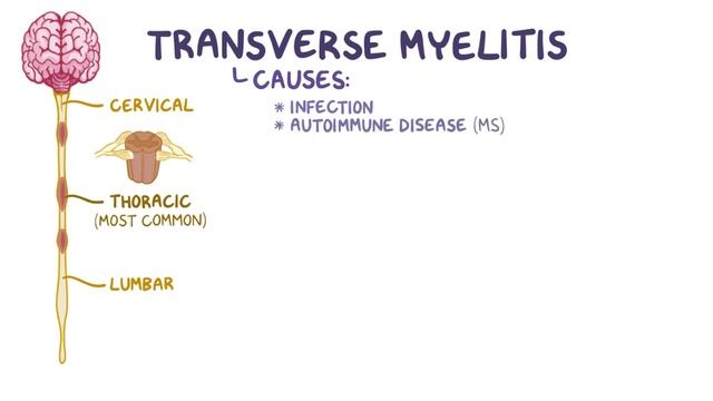 Transverse Myelitis | Osmosis