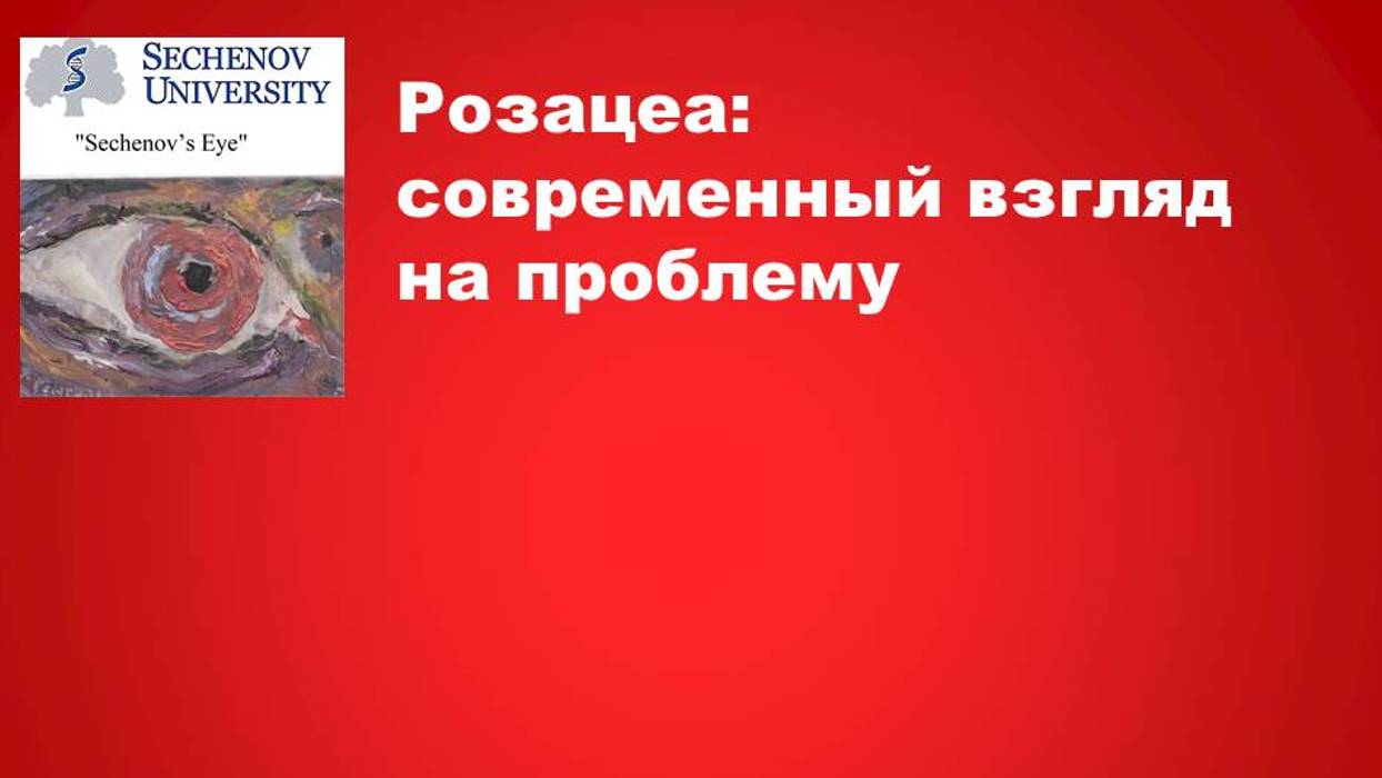 Розацеа: современный взгляд на проблему