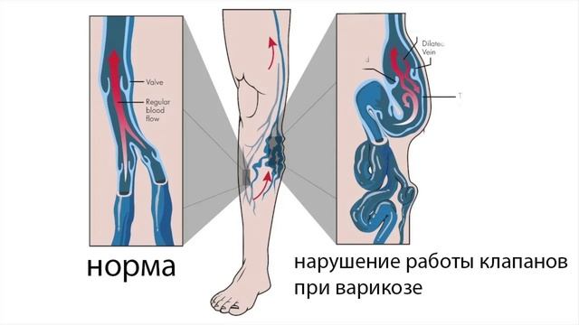 Почему важно узи вен перед любой операцией?